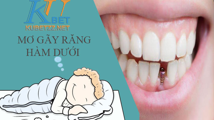 Giấc mơ thấy gãy răng hàm dưới đánh con gì - Giải mã giấc mơ