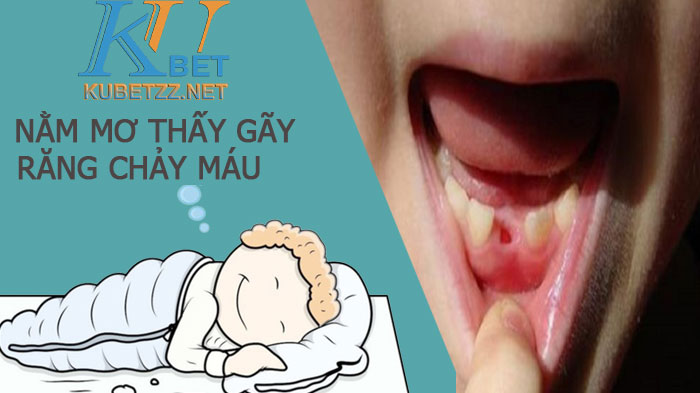 Nằm mơ thấy gãy răng chảy máu gặp điềm gì - đánh con gì trúng lớn?